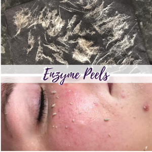 Online LED and Dermaplaning Course training