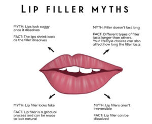 Lip Fillers Norfolk Thetford Norwich Bury St edmunds