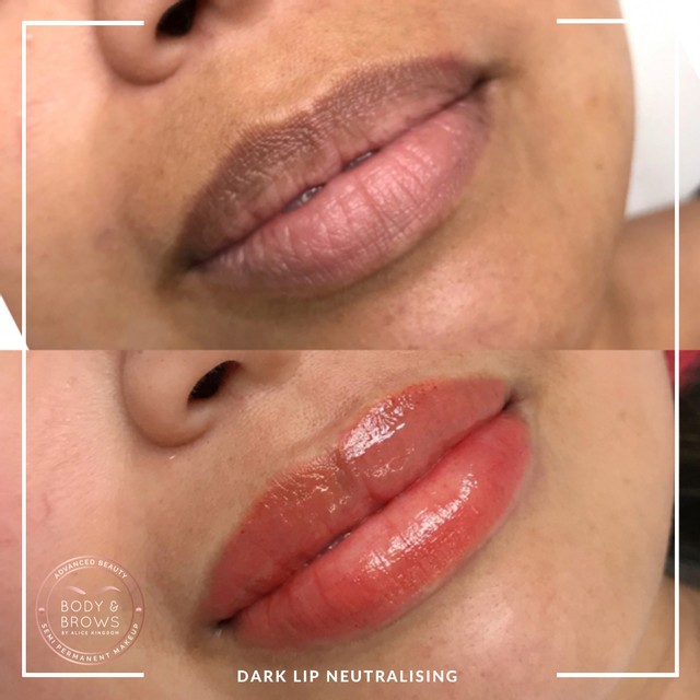 Dark Lip Tattoo Neautralising